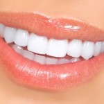 whiten teeth